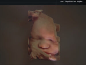 Ultrassonografia Obstétrica 4D HD Live (10)