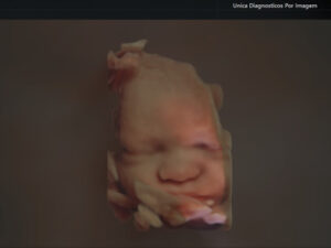 Ultrassonografia Obstétrica 4D HD Live (11)
