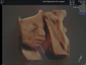 Ultrassonografia Obstétrica 4D HD Live (18)