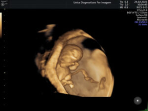 Ultrassonografia Obstétrica 4D HD Live (6)