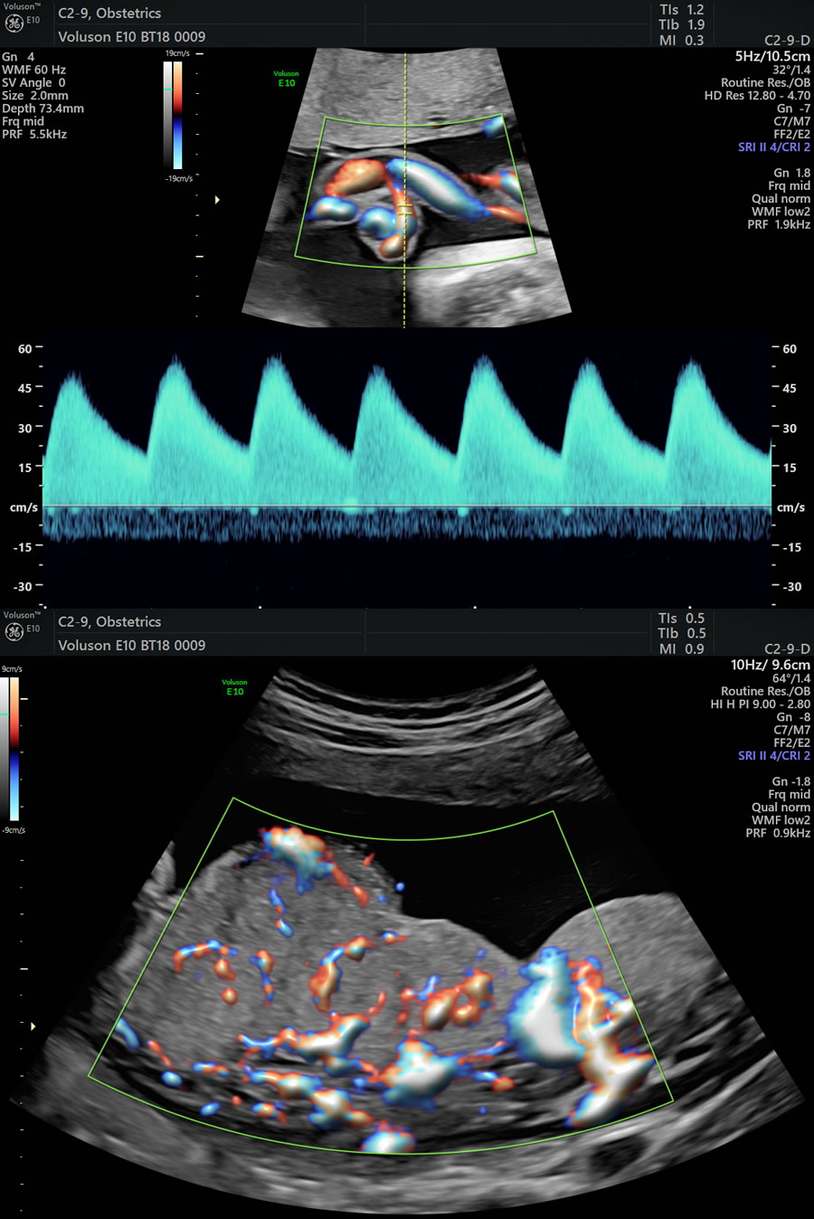 Ultrassom Obstétrico com Doppler