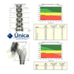 Densitometria óssea